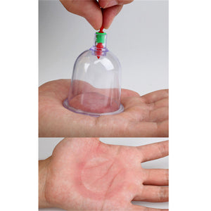 Sukshen 12 Piece Cupping System